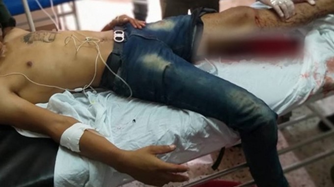Delincuente herido OK