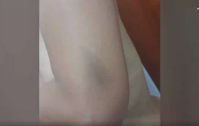 Revelan fotos de cómo quedó el cuerpo de la teniente que habría sido abusada por un capitán de la Policía 3 foto 2