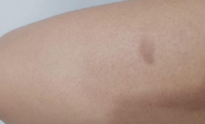 Revelan fotos de cómo quedó el cuerpo de la teniente que habría sido abusada por un capitán de la Policía 6 foto 5