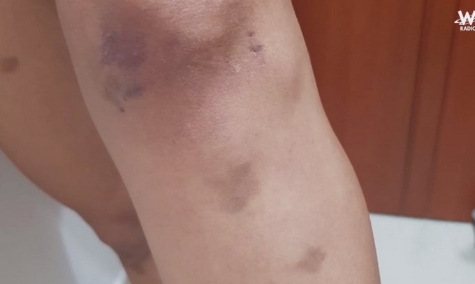 Revelan fotos de cómo quedó el cuerpo de la teniente que habría sido abusada por un capitán de la Policía 9 foto 8