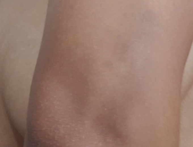 Revelan fotos de cómo quedó el cuerpo de la teniente que habría sido abusada por un capitán de la Policía 10 foto 9