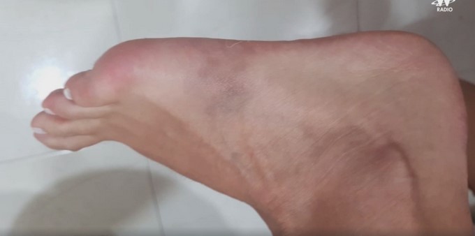 Revelan fotos de cómo quedó el cuerpo de la teniente que habría sido abusada por un capitán de la Policía 11 foto