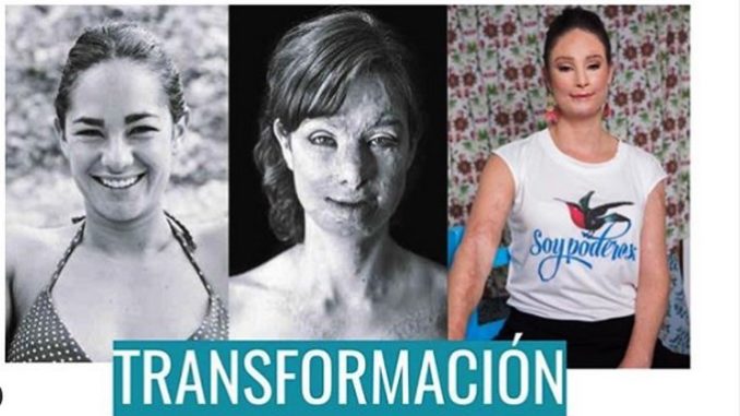La evolución; Natalia Ponce de León a cinco años de volver a vivir