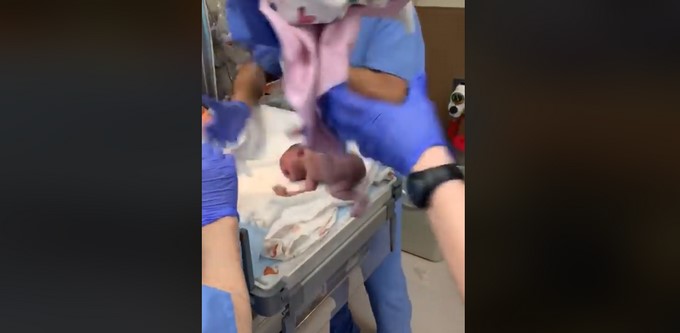 Vídeo. Médico dejó caer a una bebé de pocos minutos de nacida y le provocó una hemorragia