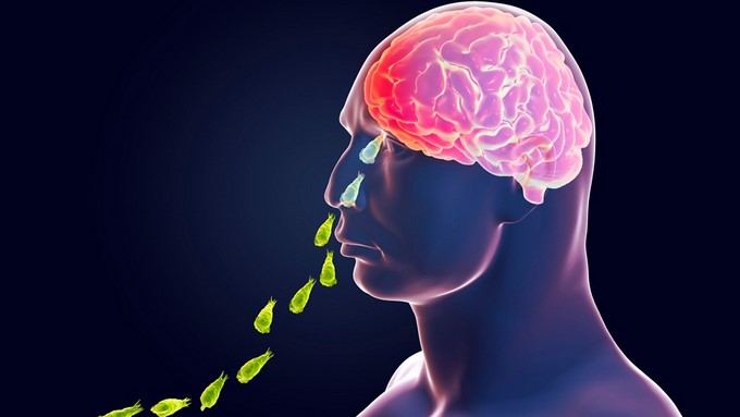 !Impactante! Un hombre murió tras infectarse con un microorganismo que se comió su cerebro en EEUU