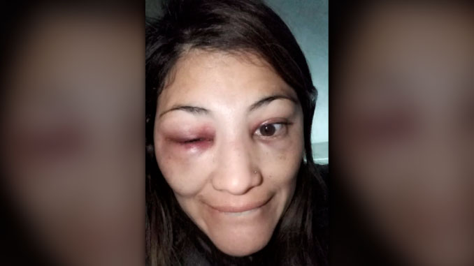 ¡Increíble! Una madre golpeó brutalmente a otra mujer porque supuestamente ella le miró feo a su hijo