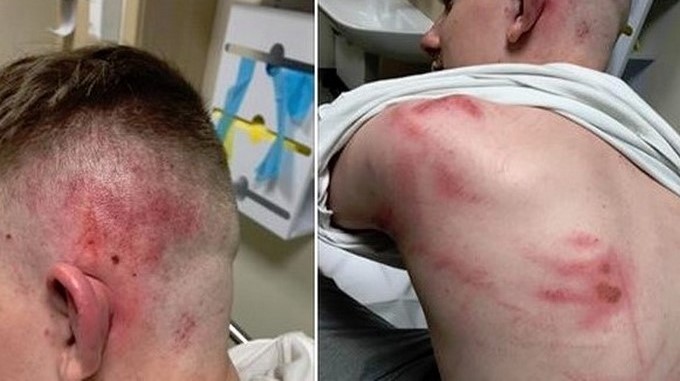 FOTOS: ¡Absurdo! “10 bastardos” le dieron tremenda paliza a joven tras defender a su amigo gay