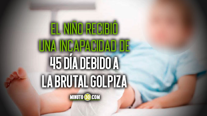 En Itagüí un sujeto partió a golpes la pierna de su hijo de 4 años porque desorganizó su habitación 1 En Itagui un sujeto partio a golpes la pierna de su hijo de 4 anos porque desorganizo su habitacion1