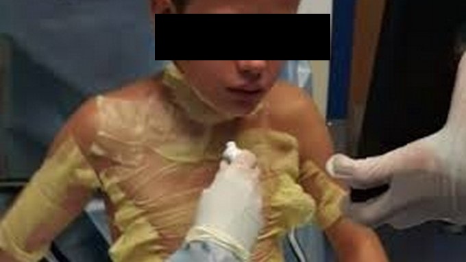 EN VIDEO: ¡Insólito! Hay un nuevo reto viral en el que se prenden fuego, un niño casi se mata solo