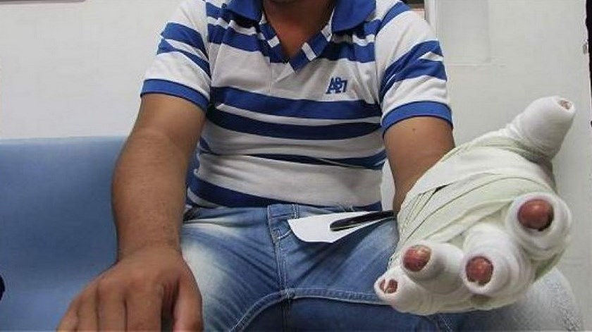 ¡Ya toca hasta cerrar las ventanas! Un volador se metió a una casa y quemó a un hombre, en Medellín