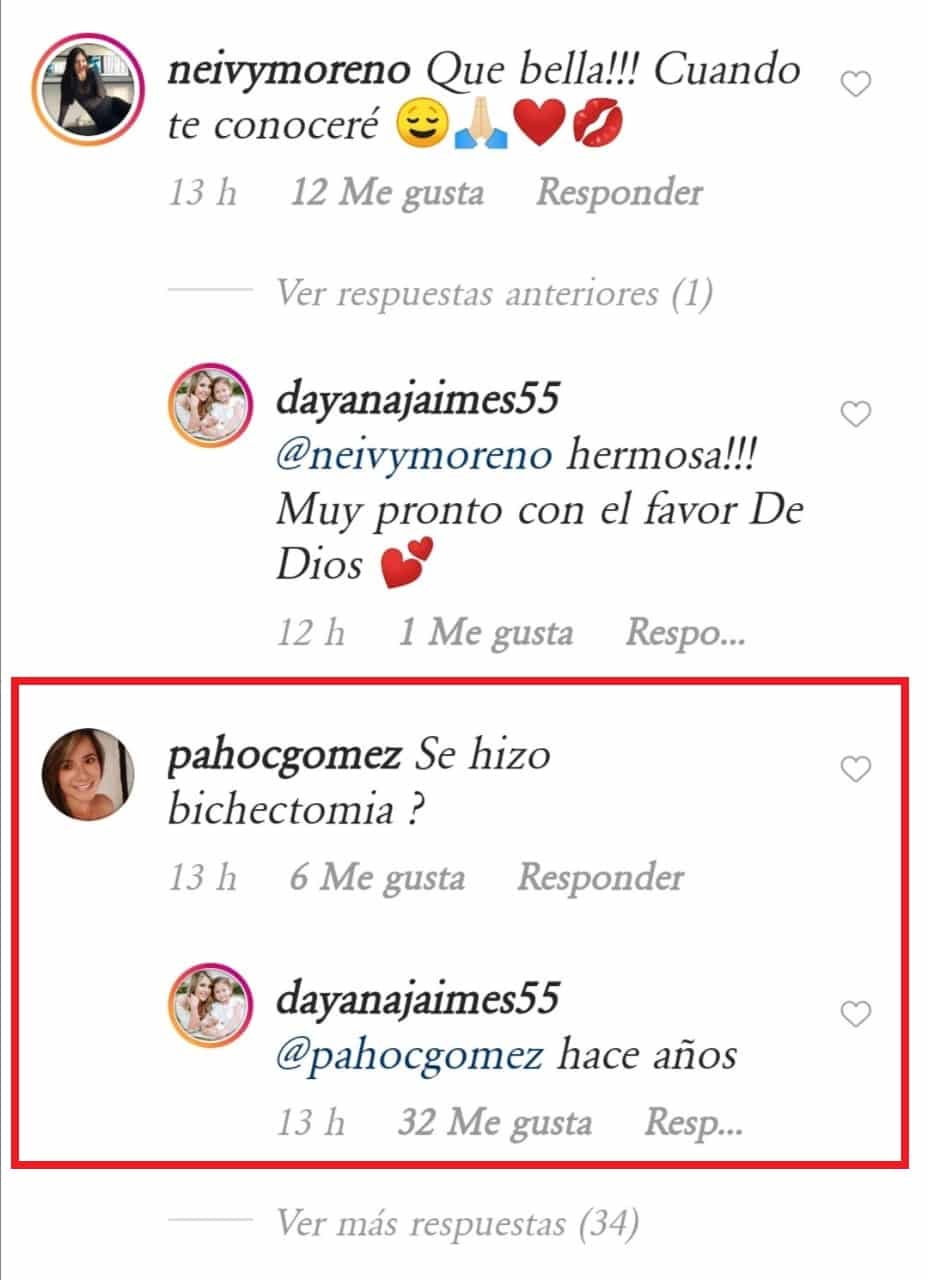 FOTO: Dayana Jaimes no lo negó más y afirmó públicamente que sí se realizó una ¡BICHECTOMÍA! 2 Bichectomia Dayana Jaimes