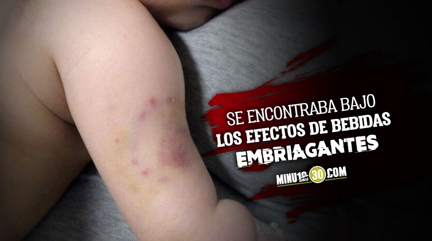 mordiscos bebé neiva