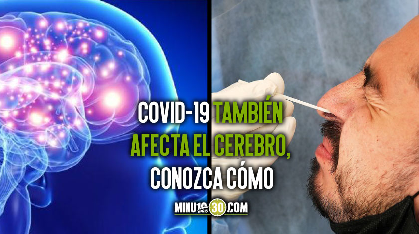 Covid-19 cerebro