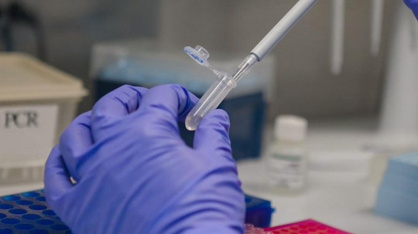 En Medellín y Antioquia se tienen al menos 19 mil pruebas de Covid represadas