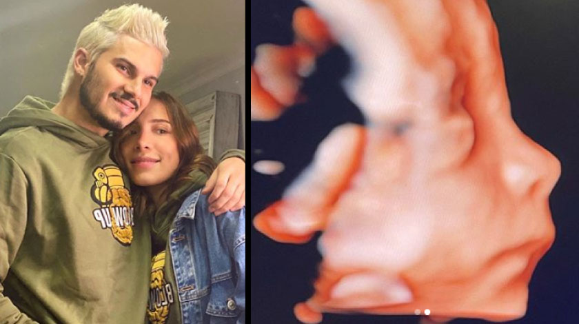 La carita más nítida del 'retoño' de Pipe Bueno y Luisa Fernanda W