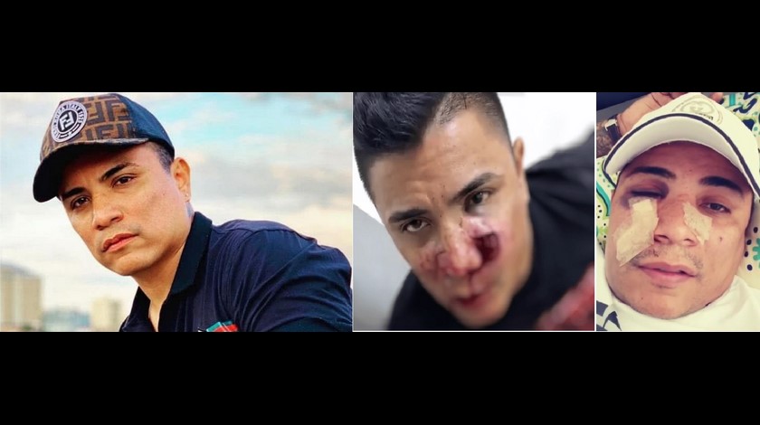 Actor colombiano busca ayuda