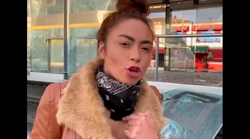 Epa Colombia cambio extremo cirugía de nariz