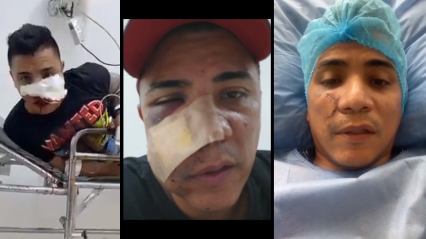 VIDEO: El actor Mauro Bastidas contó cómo sucedió el incidente que lo dejó con la cara herida