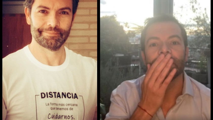 VIDEO: ¡Algo salió mal! Iván Lalinde contó el “accidente” por el que terminó calvo