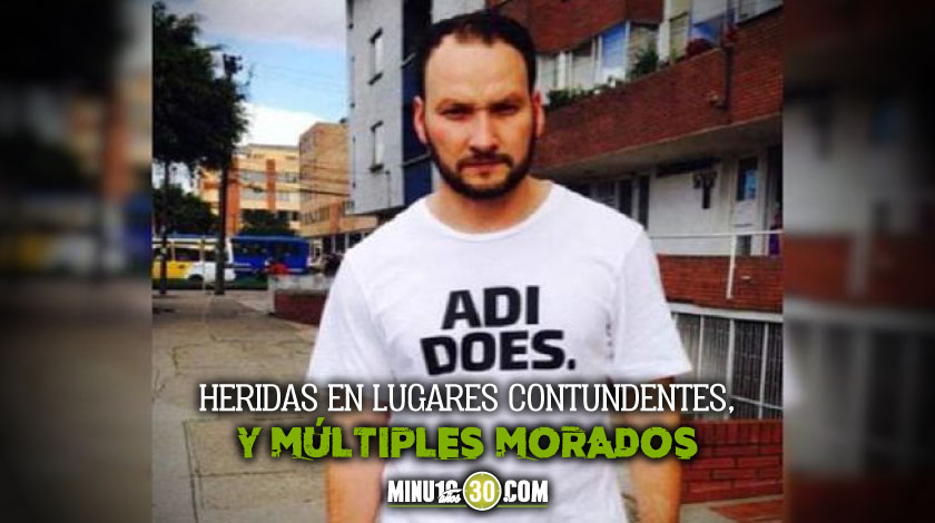 ¡Tétrico! Lo que muestran las seis fotos que se le tomaron a Javier Ordóñez en el hospital