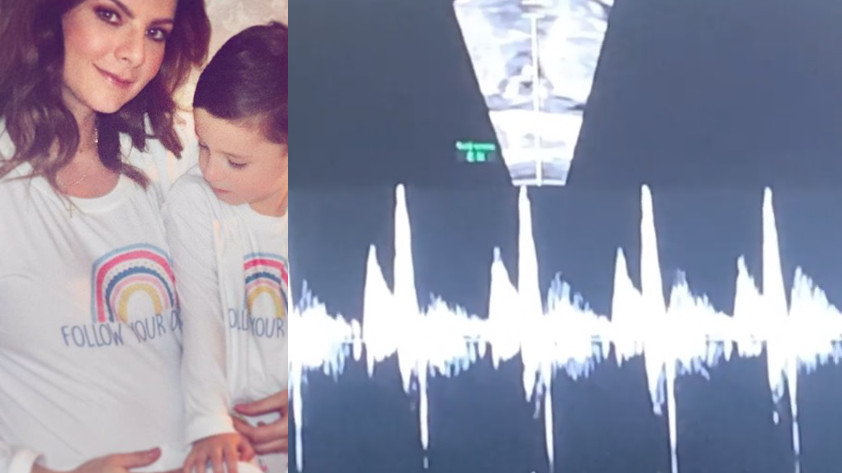 VIDEO: ¡Se escucha ‘patentico’! Lincoln Palomeque y Carolina Cruz serán padres por segunda vez, así se escucha el corazoncito del bebé