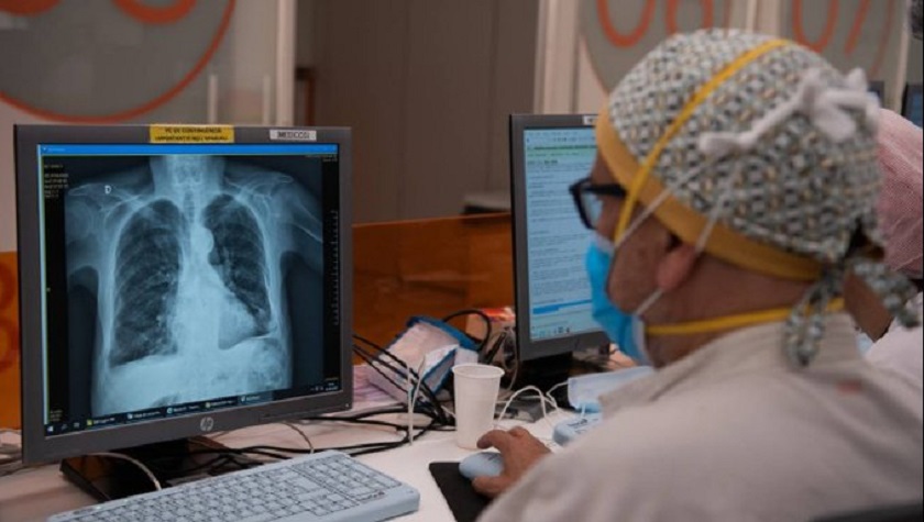 El 10% de enfermos graves con COVID-19 producen anticuerpos que empeoran la enfermedad, según estudio