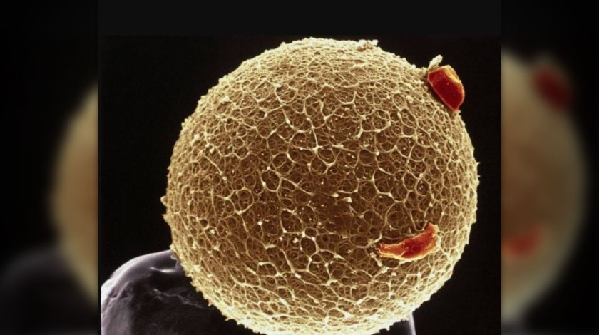 Identifican el origen genético de la insuficiencia ovárica primaria