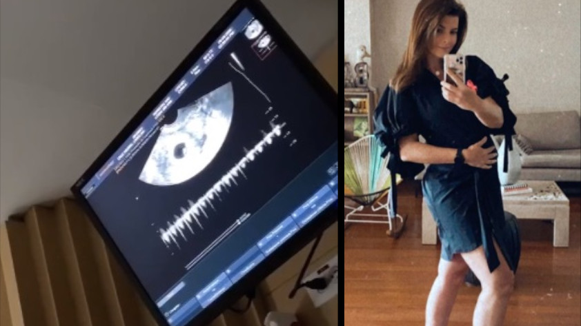VIDEO: Tras perder a un bebé a las 9 semanas, Carolina Cruz compartió los latidos de Salvador que ya viene en camino