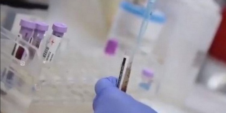 Prueba rápida Covid OPS