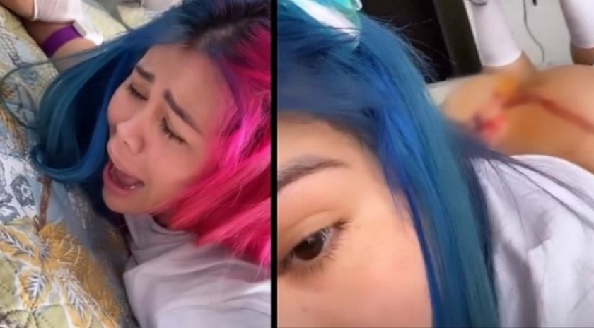 Plasma para cicatriz de Yina Calderón