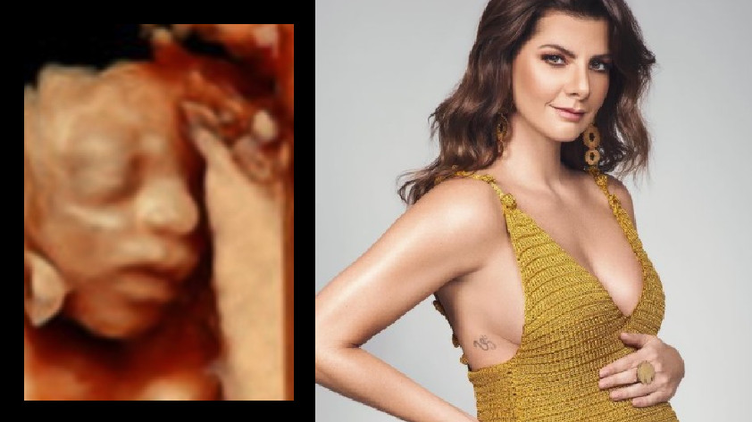 FOTO: ¡Se ve ‘claritico’! Con ecografía 3D de su hijo, Carolina Cruz anuncia que su embarazo va bien y sano