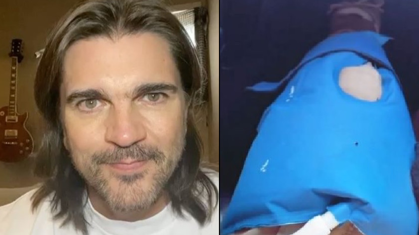 VIDEO: A Juanes lo habrían operado de la rodilla y le estarían aplicando licor para ‘adormecer’ el dolor