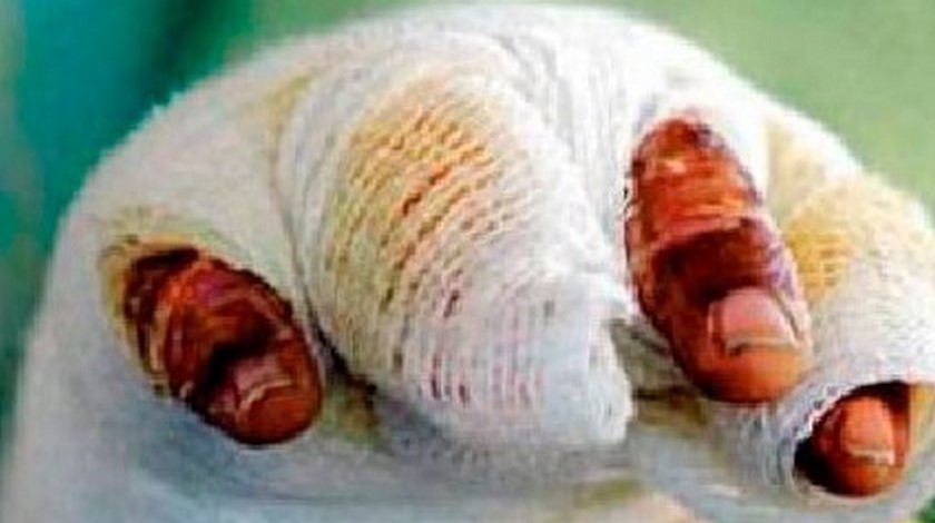 ¡Ya son seis! Joven de 18 años resultó lesionado con un ‘taco’ en Buenos Aires