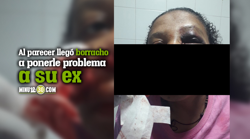 EN FOTOS: ¡Bestia! En el sector de Los Juaquinillos un sujeto atacó a machetazos a dos mujeres 1 En el sector de Los Juaquinillos un sujeto ataco a machetazos a dos mujeres