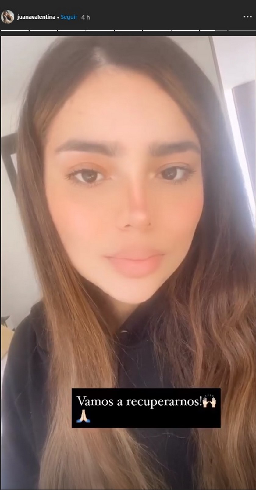 VIDEO: ¡Para quedar como una Barbie!, dejaron ver el antes y después de la lipomarcación que se hizo la hermana de James Rodríguez 6 juana