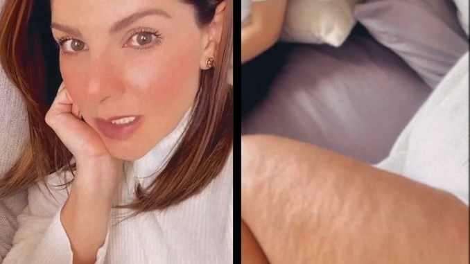 VIDEO. Carolina Cruz dejó ver la cantidad de celulitis que tiene por su embarazo