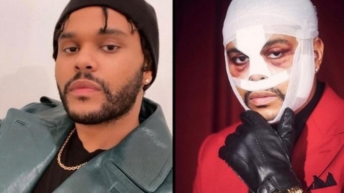 FOTOS: Los retoques estéticos The Weeknd causan revuelo en redes sociales
