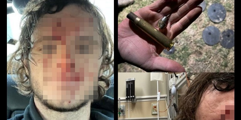 Youtuber disparó y recibió la bala en la frente