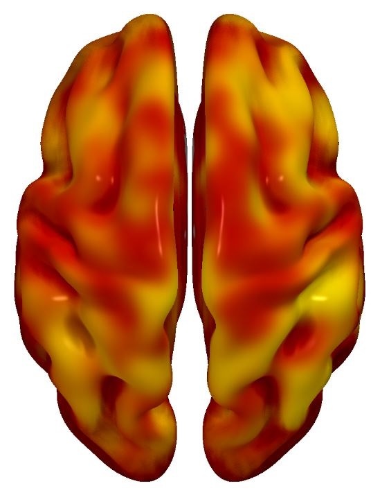 El riesgo cardiovascular y el declive cerebral se asocian en la mediana edad 3 El riesgo cardiovascular y el declive cerebral se asocian en la mediana edad 1