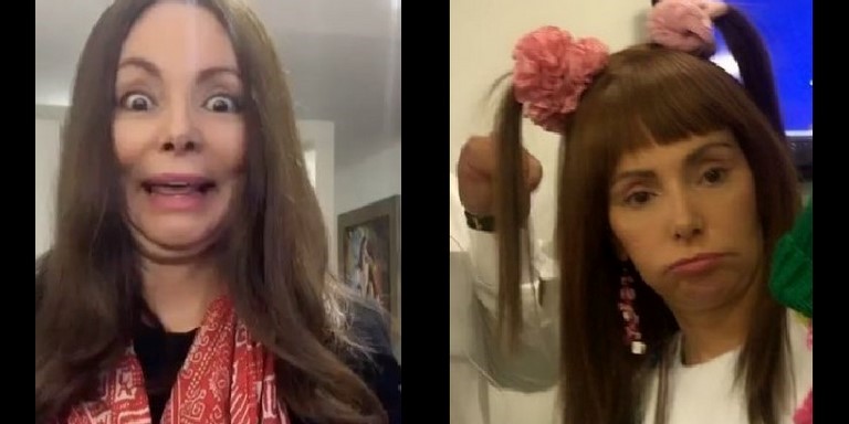 FOTO: ¡Qué dolor! La humorista María Auxilio mostró cómo tiene la pierna luego de la picadura de serpiente venenosa