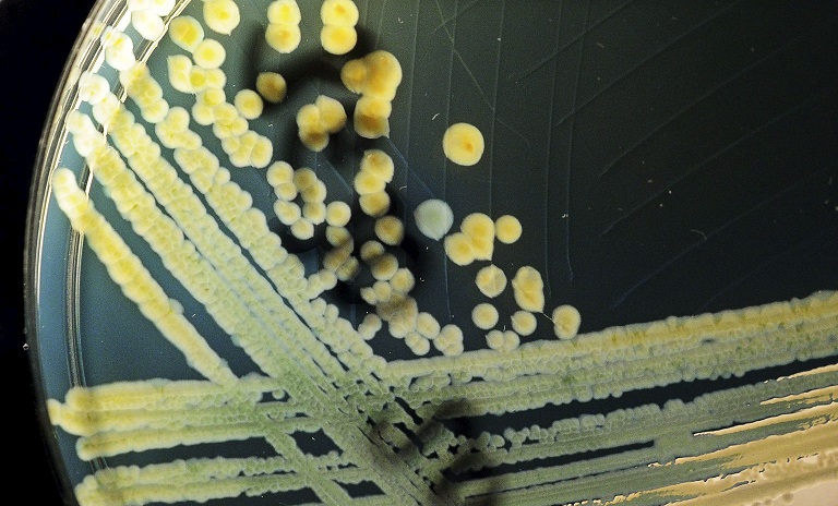 Brote de bacteria resistente a antibióticos en hospitales de Colombia