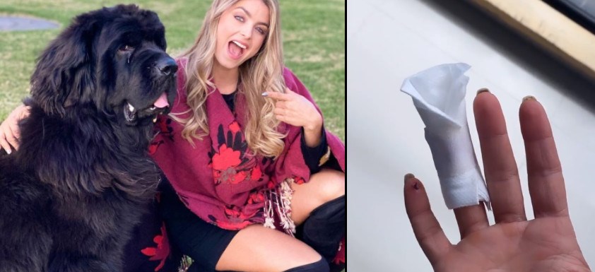 VIDEO. Cristina Hurtado fue mordida por su perro y le cogieron varios puntos de sutura