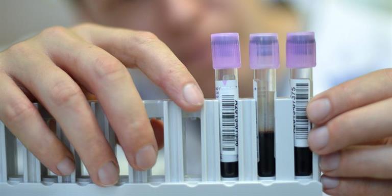 Científicos mexicanos desarrollan pruebas en sangre para cáncer de pulmón 1 pruebas cancer pulmon