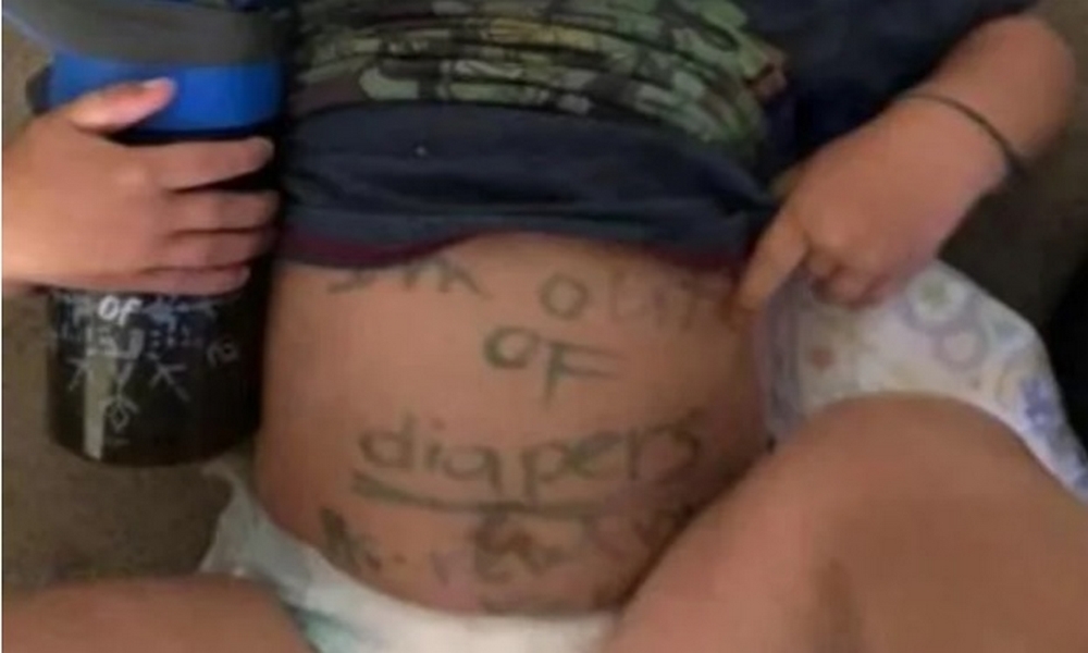 En Estados Unidos, madre enfurece luego de que le enviaran una nota escrita en el estómago de su hijo