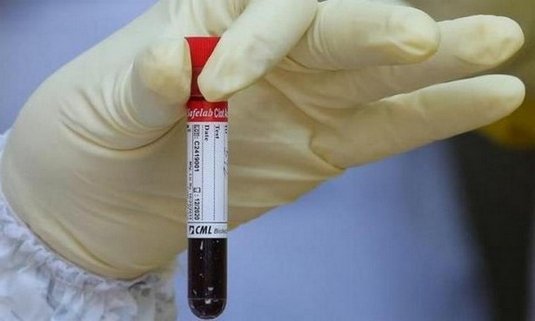 Covid-19 y sangre tipo A