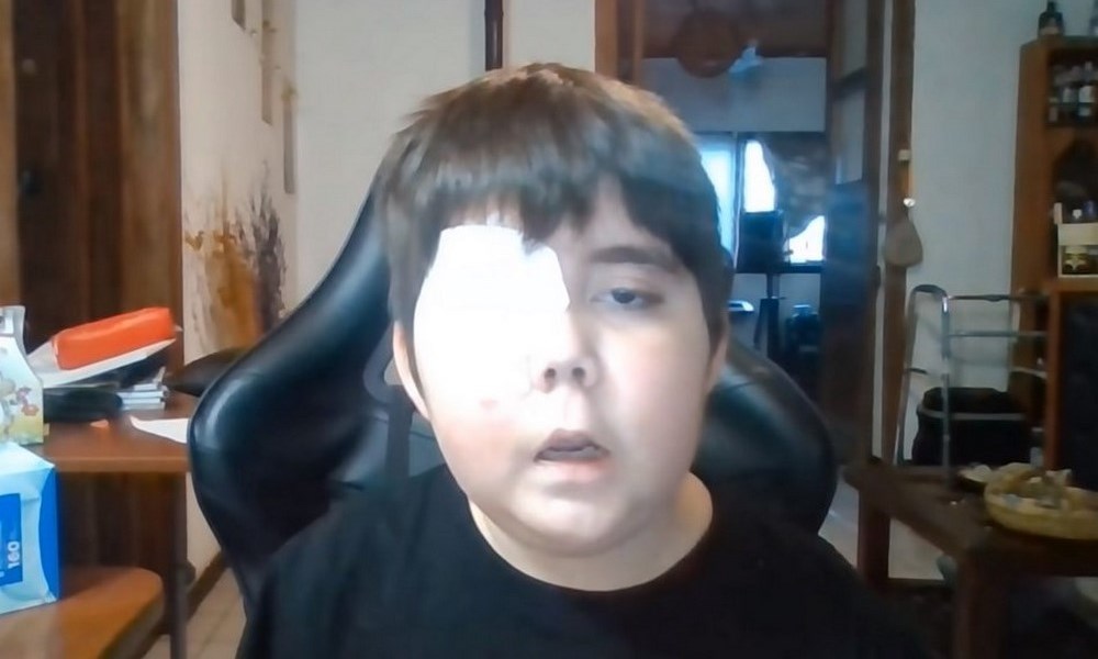 VIDEO. Niño con 'cáncer cerebral' cumplió su sueño y rompe récords en YouTube 1 Nino con cancer cerebral