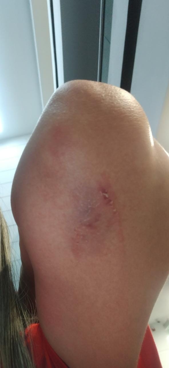 FOTOS: Denuncian que un extranjero agredió a una mujer en El Poblado 2 El Poblado-agresión