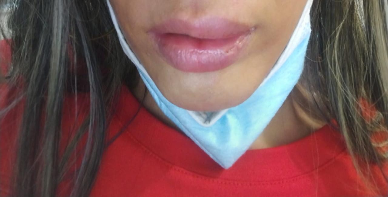 FOTOS: Denuncian que un extranjero agredió a una mujer en El Poblado 3 El Poblado-agresión