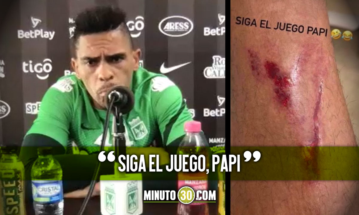 Jonnathan-alvez-hizo-publicas-las-heridas-que-le-dejo-partido-ante-La-Equidad