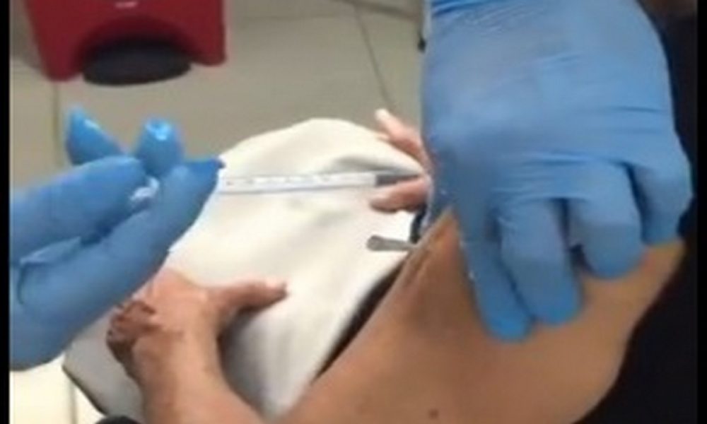 Magangué-error-vacunación